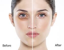 serum chăm sóc da vùng mắt KSE 26 giá tốt